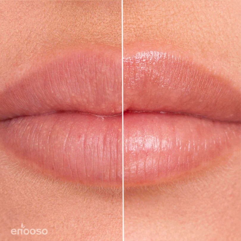 Balsamo Labbra Mora e Mirtillo 10 ml Enooso