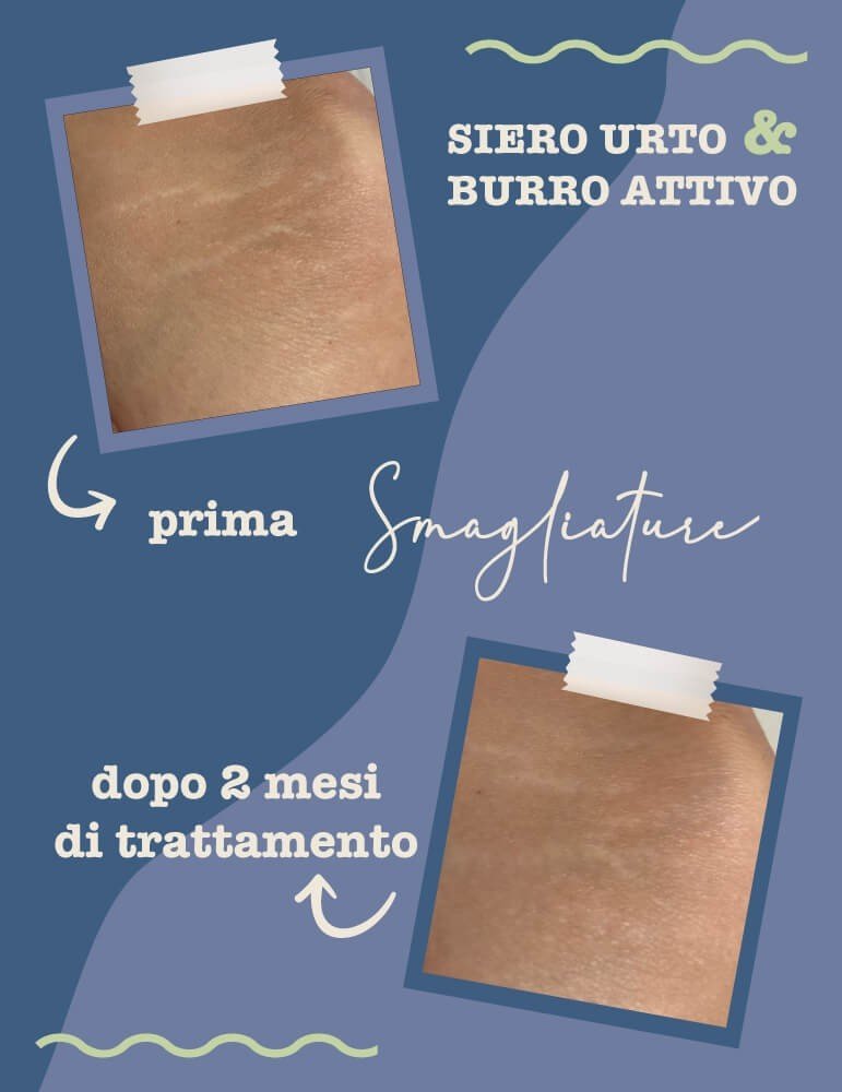 Burro attivo Smagliature 150 ml LA SAPONARIA