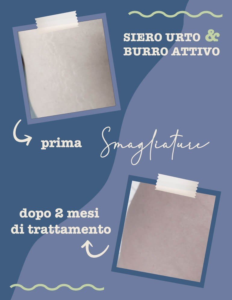 Burro attivo Smagliature 150 ml LA SAPONARIA