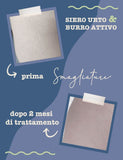 Burro attivo Smagliature 150 ml LA SAPONARIA